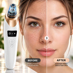 Pore Cleaner Blackhead Remover Ultimate